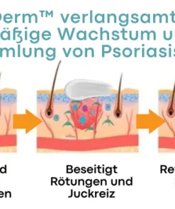 BeeDerm™ Bienengift Psoriasis Behandlungscreme