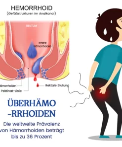 Biancat™ AnalEase Hämorrhoiden-Reparatur Kräuterkapseln