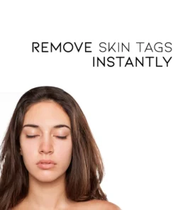 Bostore™ Tags & Moles Remover