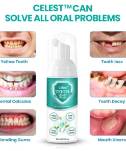 Celest™ TEETH Mouthwash - Solve all Oral Problems