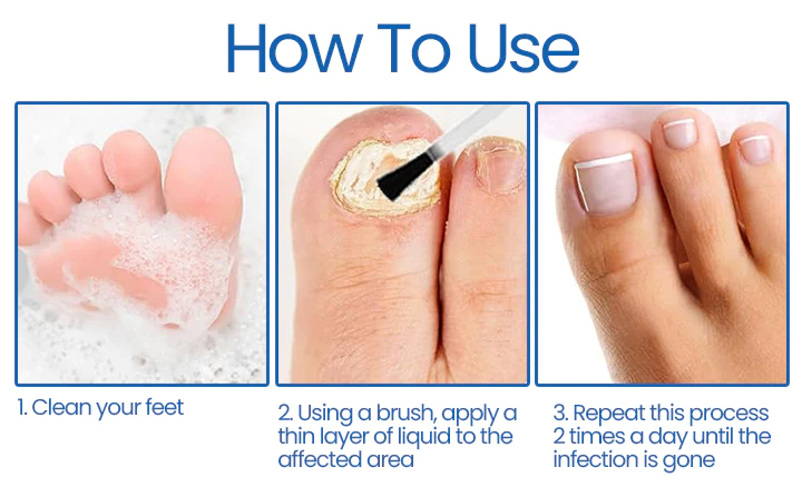 Ceoerty™ NailHeal: Herbal nail repair gel