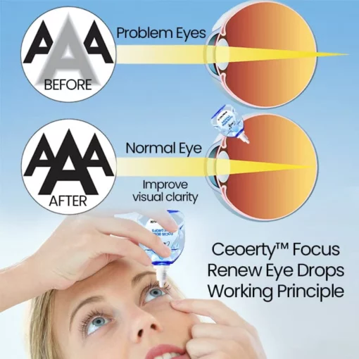 Ceoerty™ Focus Renew Eye Drops