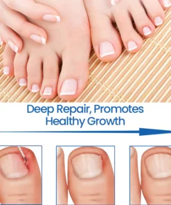 Ceoerty™ NailHeal: Herbal nail repair gel