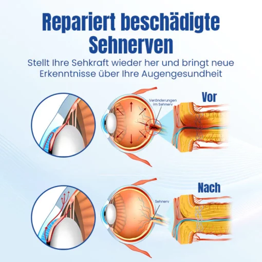 Ceoerty™ OptiRenew Augenbehandlungstropfen