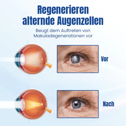 Ceoerty™ OptiRenew Augenbehandlungstropfen