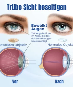 Ceoerty™ OptiRenew Augenbehandlungstropfen