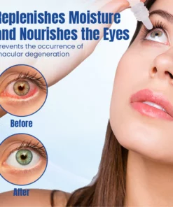 Ceoerty™ OptiRenew Eye Treatment Drops