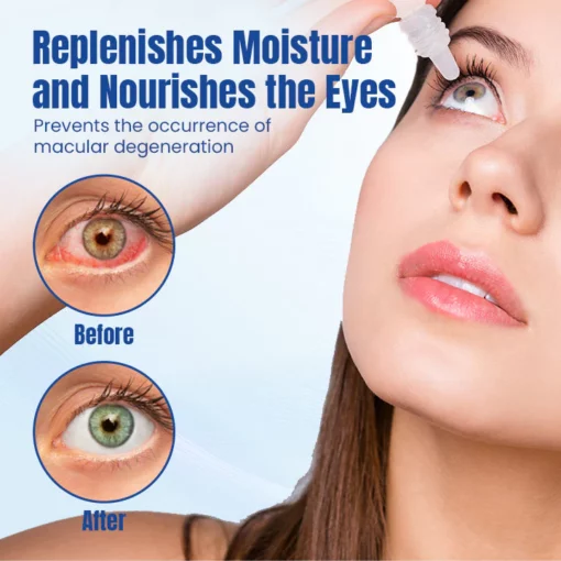 Ceoerty™ OptiRenew Eye Treatment Drops