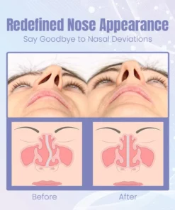 Ceoerty™ Sculptify Nose Enhancer Device