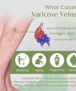 Ceoerty™ VeinCare Varicose Treatment Spray