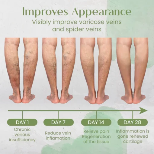 Ceoerty™ VeinCare Varicose Treatment Spray - Image 4