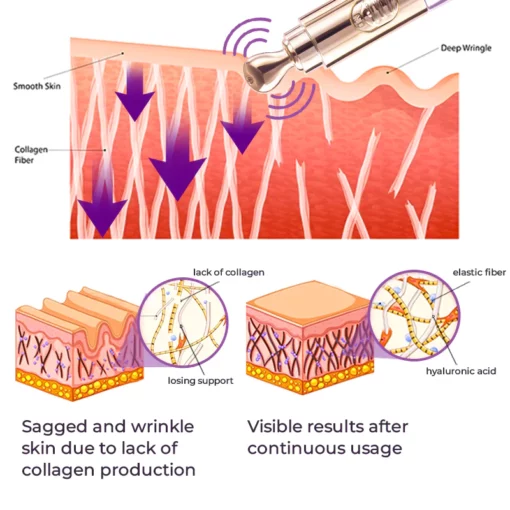 Dobshow™ RadianceEyes Pro-Vibrance Eye Cream Pen