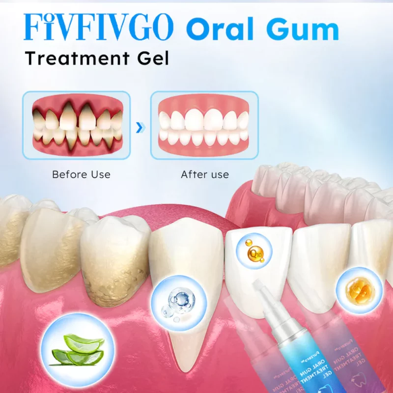 Fivfivgo™ Zahnfleischgel zur oralen Behandlung