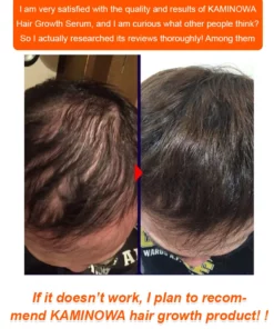 Hair Growth Serum