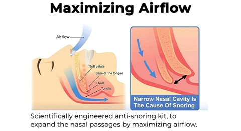 Pinza nasal magnética antironquidos Oveallgo™