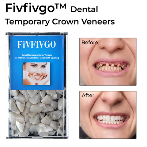 Oveallgo™ Dental Temporary Crown Veneers