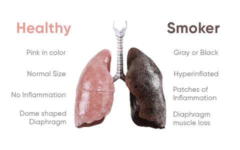 Oveallgo™ PuffStop Quit Smoking Inhaler

