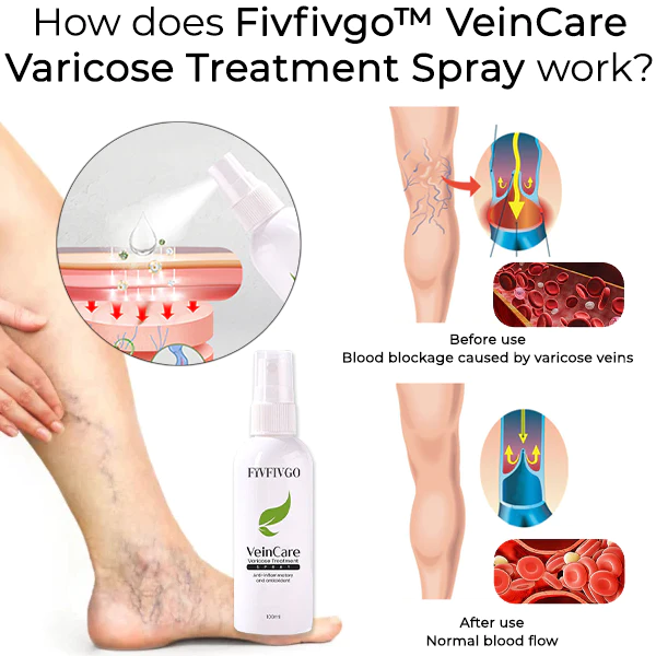 Oveallgo™ VeinCare Varicose Treatment Spray