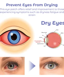 RICPIND Sight Renew Electric Ocular Vitality Device