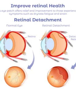 RICPIND Sight Renew Electric Ocular Vitality Device