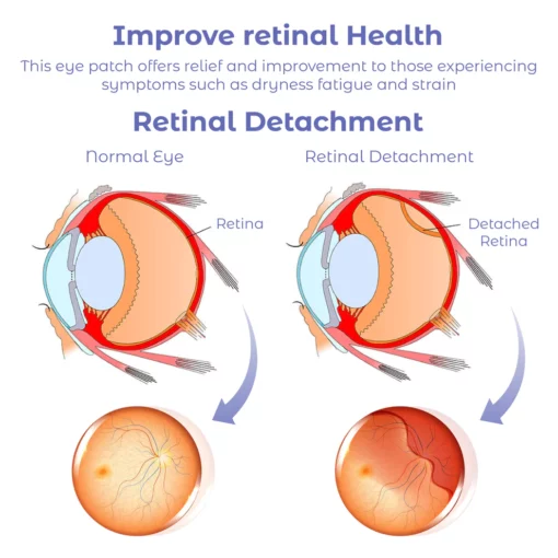 RICPIND Sight Renew Electric Ocular Vitality Device