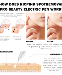 RICPIND SpotRemoval Pro Beauty Electric Pen