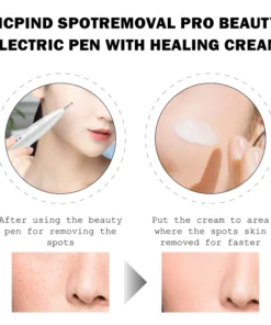 RICPIND SpotRemoval Pro Beauty Electric Pen