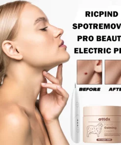 RICPIND SpotRemoval Pro Beauty Electric Pen