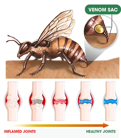 Raindew™ Bee Venom Joint Therapy Pain Relief Gel