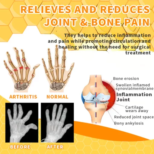 Raindew™ Bee Venom Joint Therapy Pain Relief Gel