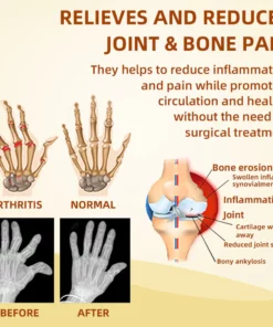 Raindew™ Canadian honey bee Venom Pain and Bone Healing Cream