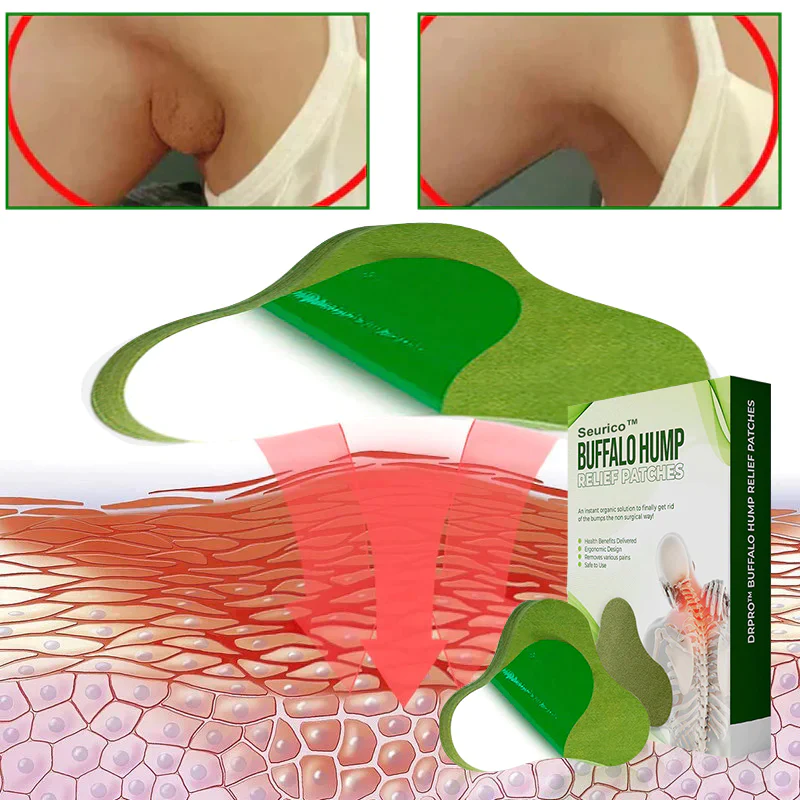 Seurico™ Lymphatic Drainage Patches 
