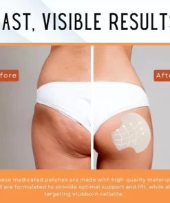 Seurico™ Butt-Lift Shaping Pads