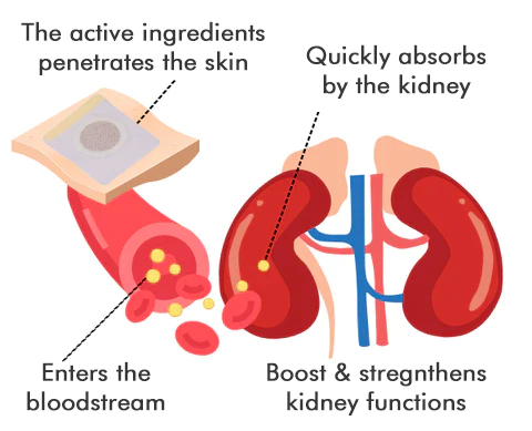 Seurico™ Kidney Care Patch