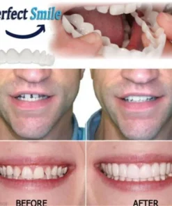 Seurico™ Smile OrthoCraft