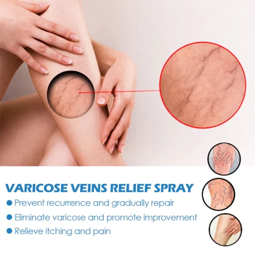 Seurico™ Vein Varicose Relief Spray