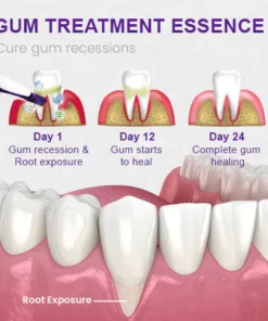 UNPREE™ Gum Treatment Essence