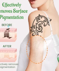 Biancat™ PureSkin Tattoo Removal Cream