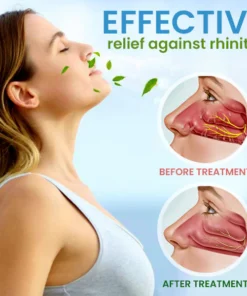 BreathLux™ Rhinitis Relief Cream