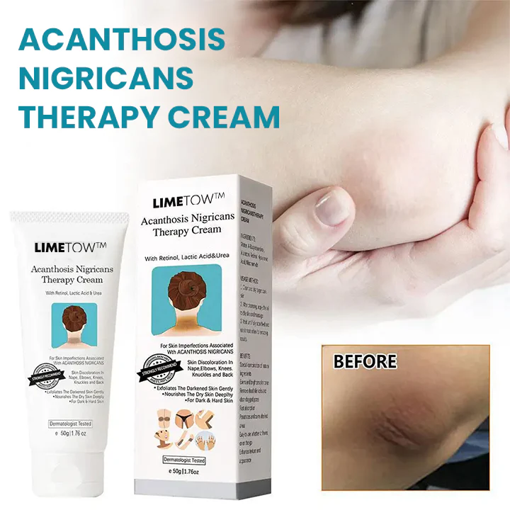 LIMETOW™ Acanthosis Nigricans Therapy Cream