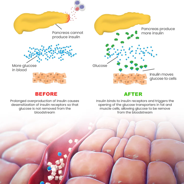 Luhaka™ GlucoCare Sugar Control Patch 