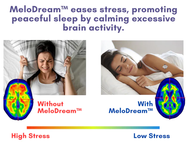 MeloDream™ Melatonin Sleep Patches