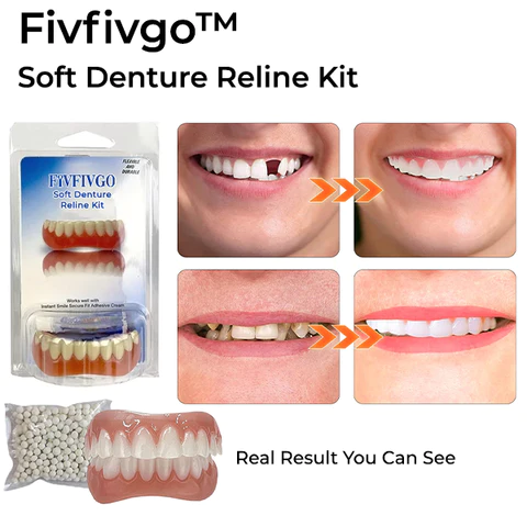 Oveallgo™ Soft Denture Reline Kit