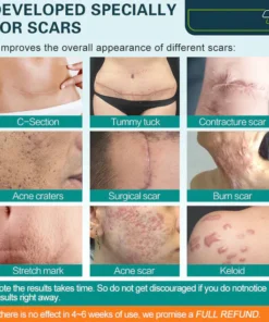 SCARGone™ Advanced Scar Spray