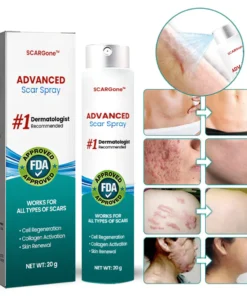 SCARGone™ Advanced Scar Spray