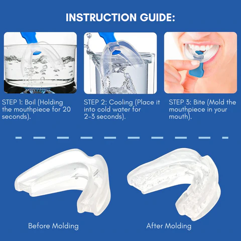 SilentBite™ Anti-Snoring Mouthpiece