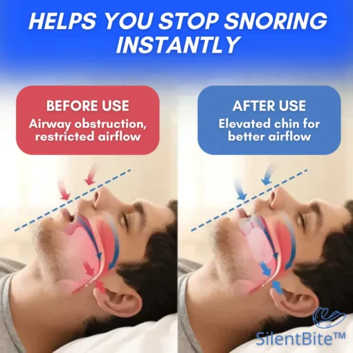 SilentBite™ Anti-Snoring Mouthpiece