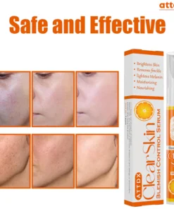 ATTDX ClearSkin Blemish Control Serum