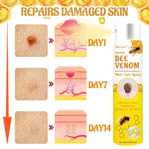 Biancat™ Bee Venom Wart Care Spray