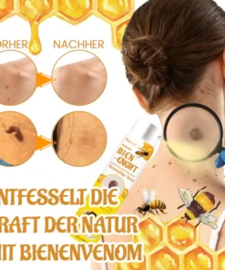 Biancat™ Bienenstich-Warzenpflegespray